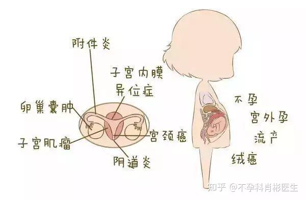 通草的功效与作用能通输卵管堵塞,精细评估解析_尊享版64.129