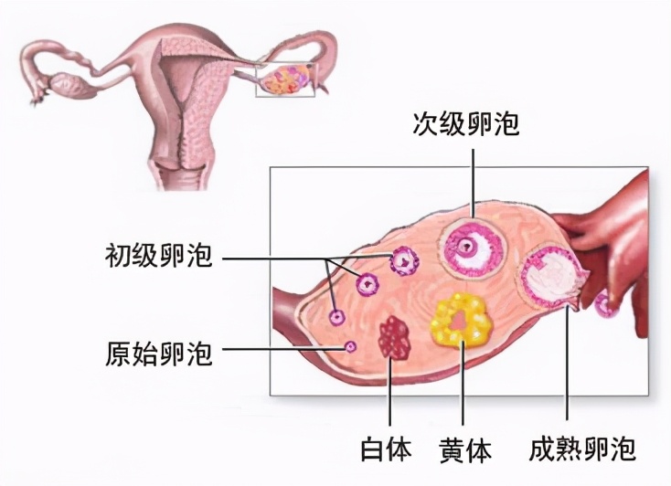 夫妻玩闹引发妻子黄体破裂